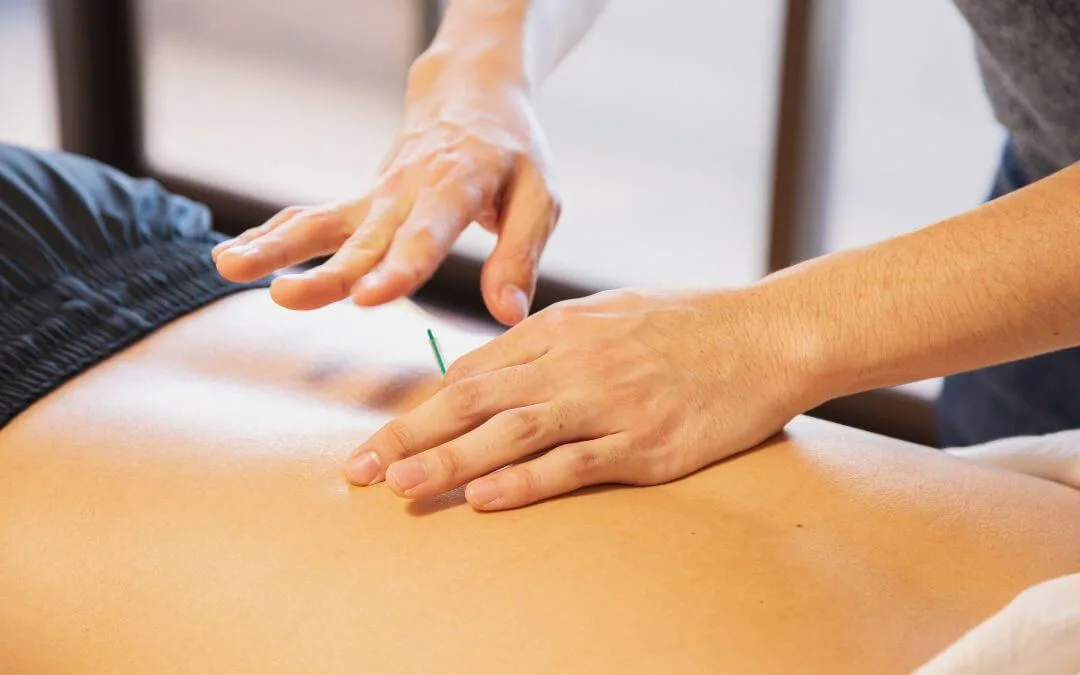 Dry Needling, Pro7 Wellness, Shanmukh Beldore, Therapy